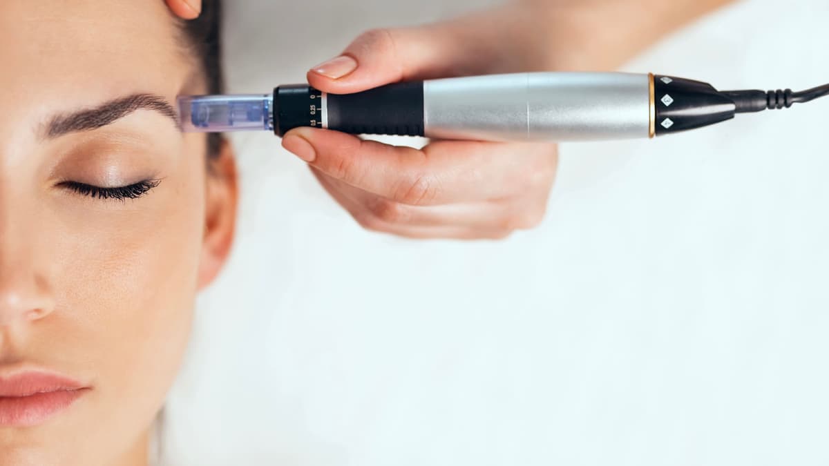 MICRONEEDLING