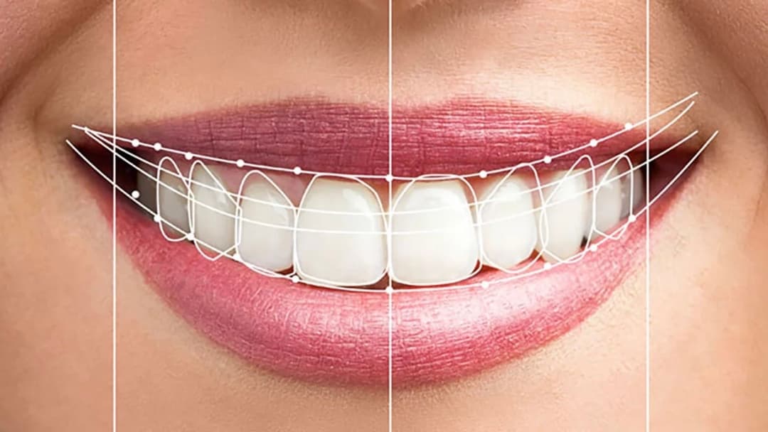 Dentisterie esthétique