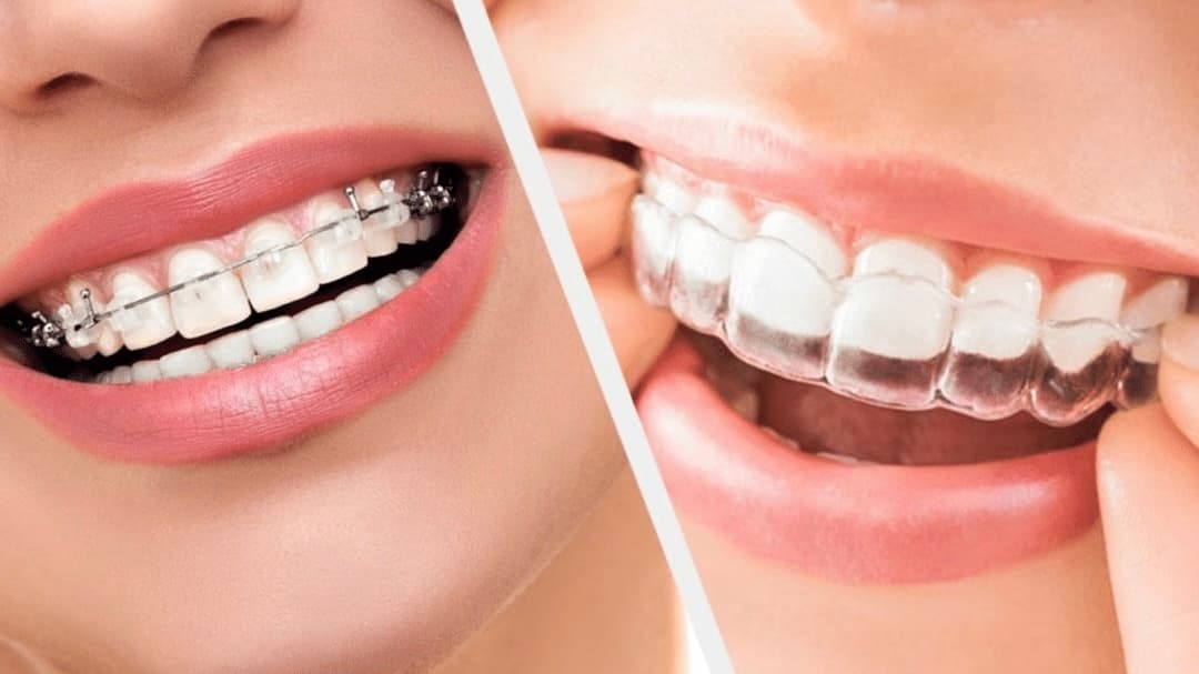 Orthodontie
