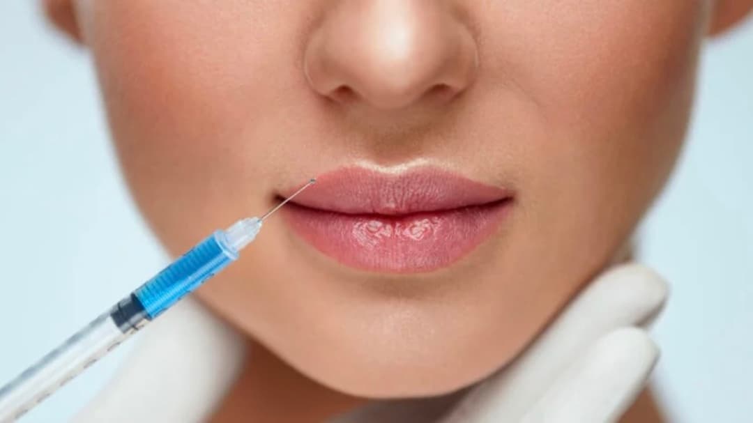 Injections d'acide hyaluronique